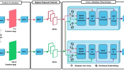 TransReg: Cross-transformer as the Auto-registration Module for Multi-view Mammogram Mass Detection featured image
