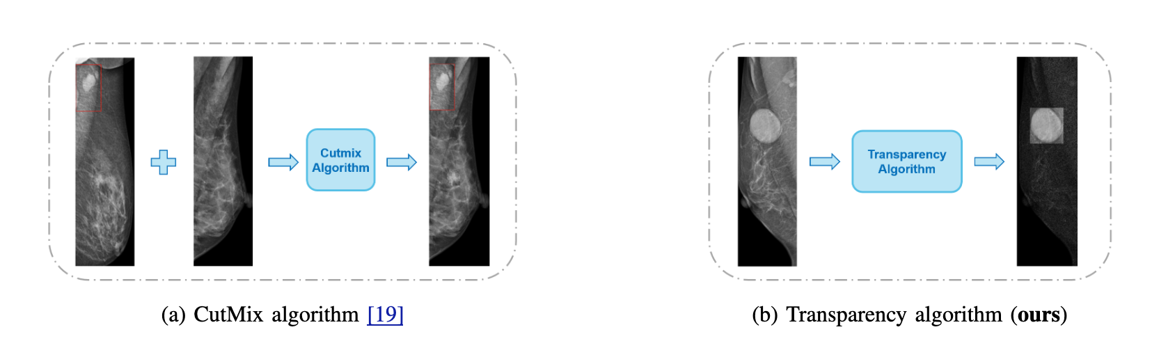 A Novel Transparency Strategy-based Data Augmentation Approach for BI-RADS Classification of Mammograms featured image