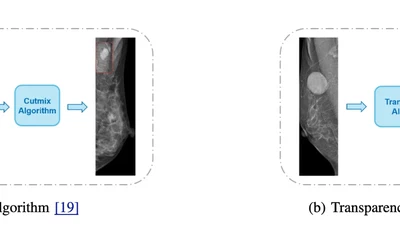 A Novel Transparency Strategy-based Data Augmentation Approach for BI-RADS Classification of Mammograms featured image